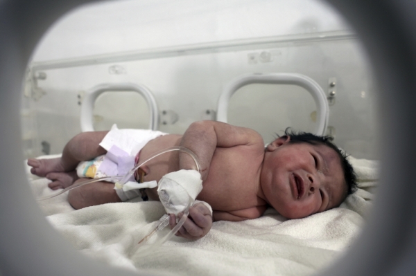 시리아 지진 피해 지역에서 숨진 엄마와 탯줄이 연결된 채로 구조된 신생아가 인큐베이터에서 치료를 받고 있다. (사진=연합뉴스)