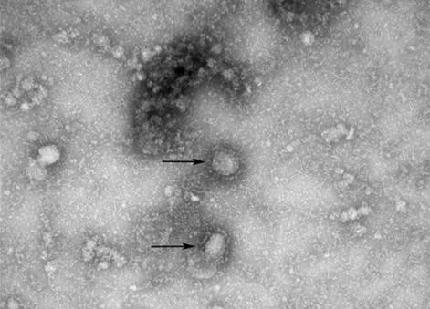 신종 코로나바이러스 전자현미경 사진. (사진=질병관리본부)