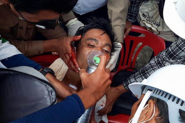 미얀마 남부도시 다웨이에서 28일 열린 반쿠데타 시위에 참가했다가 다쳐서 의료진의 치료를 받고 있는 시민. (사진=연합뉴스)